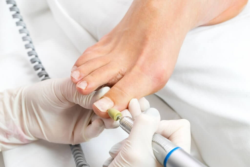 Medical pedicure